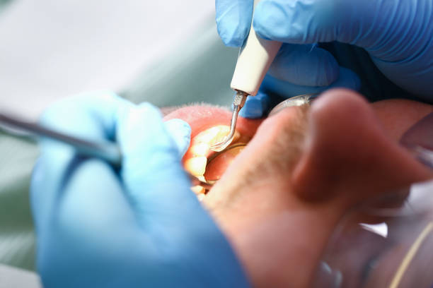 Best Weekend Emergency Dentist in Hilton Head Island, SC
