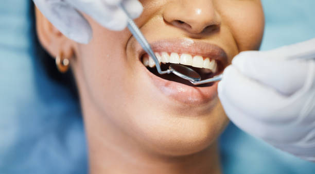 Best Emergency Dental Extractions in Hilton Head Island, SC